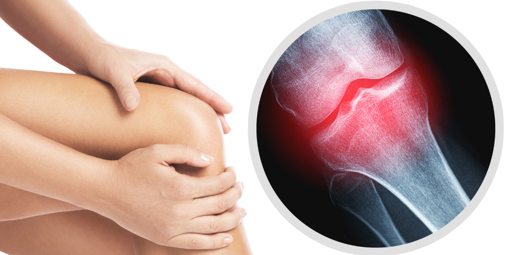 Strengthen Your Bones with the Best Vitamin D3 Supplements for Bone Health